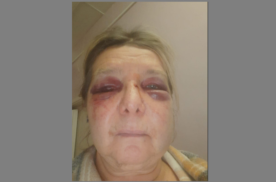 Пострадавшая пенсионерка Надежда Петросян